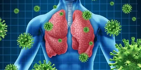 INFECCIONES RESPIRATORIAS