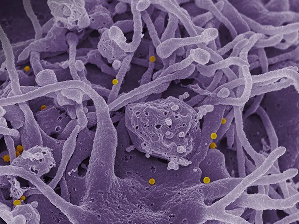 CCHF_virus