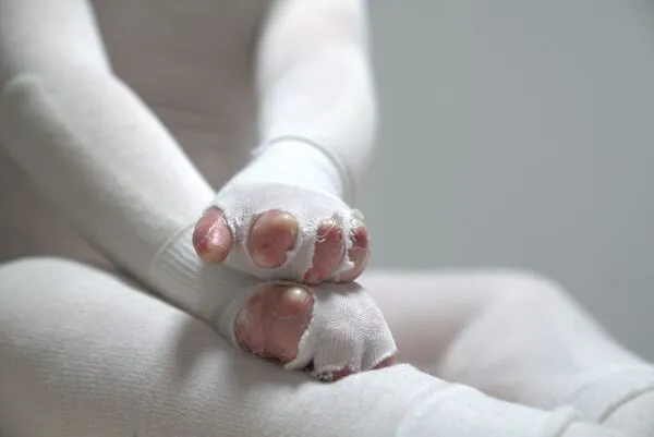 DEBRA PIEL DE MARIPOSA