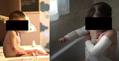 DEBRA PIEL DE MARIPOSA